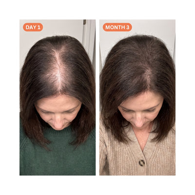 Exosome Scalp Ampoule