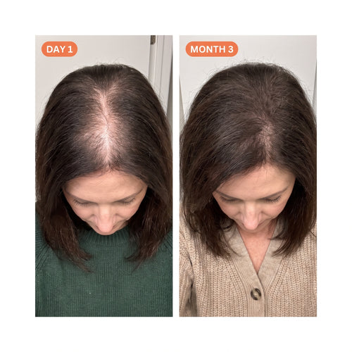 Exosome Scalp Ampoule