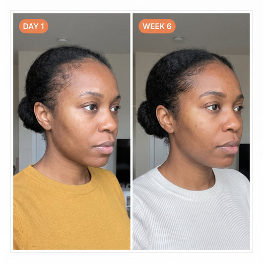 Exosome Scalp Ampoule