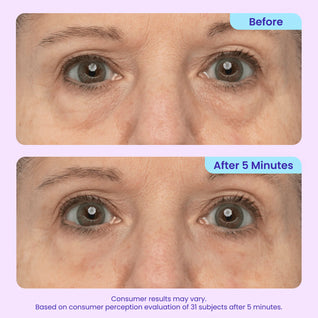 Instant Lift Eye Gel — Tightens, Lifts & Depuffs in 5 Minutes