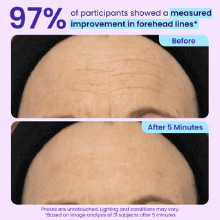 Instant Lift Eye Gel — Tightens, Lifts & Depuffs in 5 Minutes