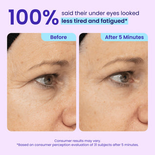 Instant Lift Eye Gel — Tightens, Lifts & Depuffs in 5 Minutes