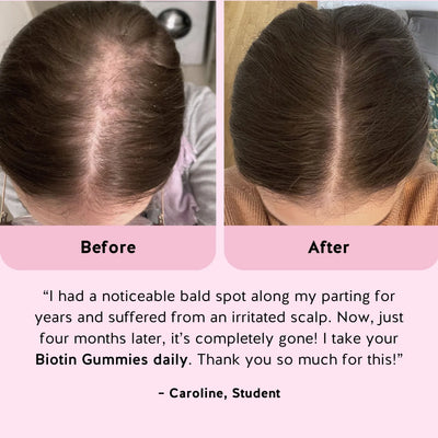 Hair Reset Gummies