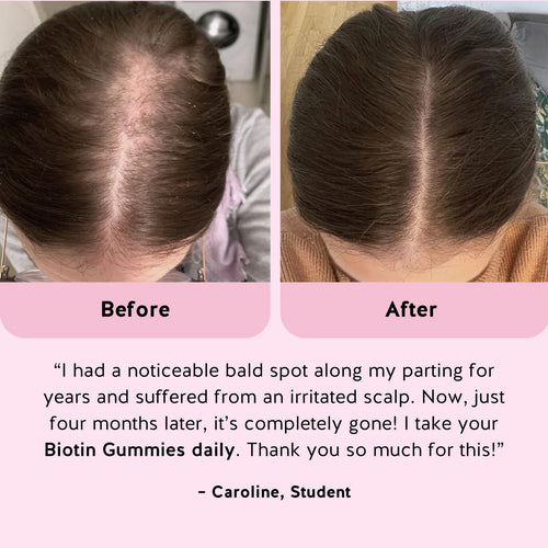 Hair Reset Gummies