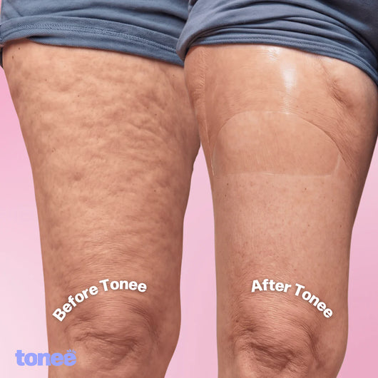 Instant Lift Tape - Legs, Arms and Tummy